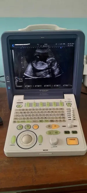 Fukuda Uf-450ax Ultrasound Machine