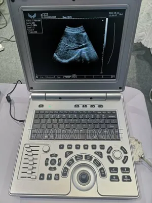 Xf Portable Ultrasound
