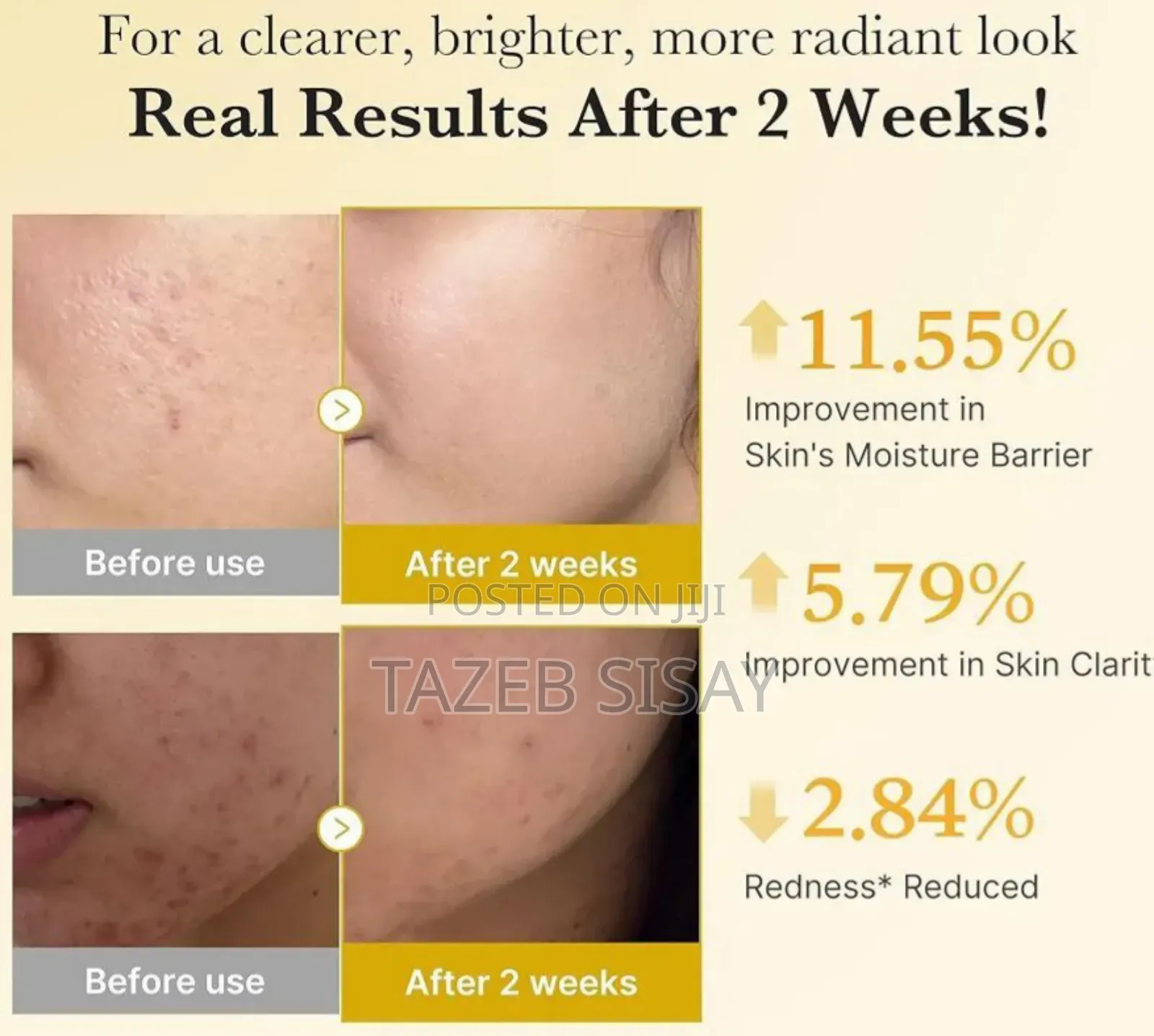 Beauty Care