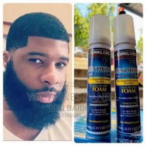 Minoxidil Foam