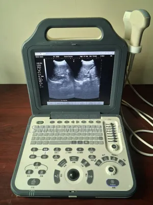 Emp-n2 Machine