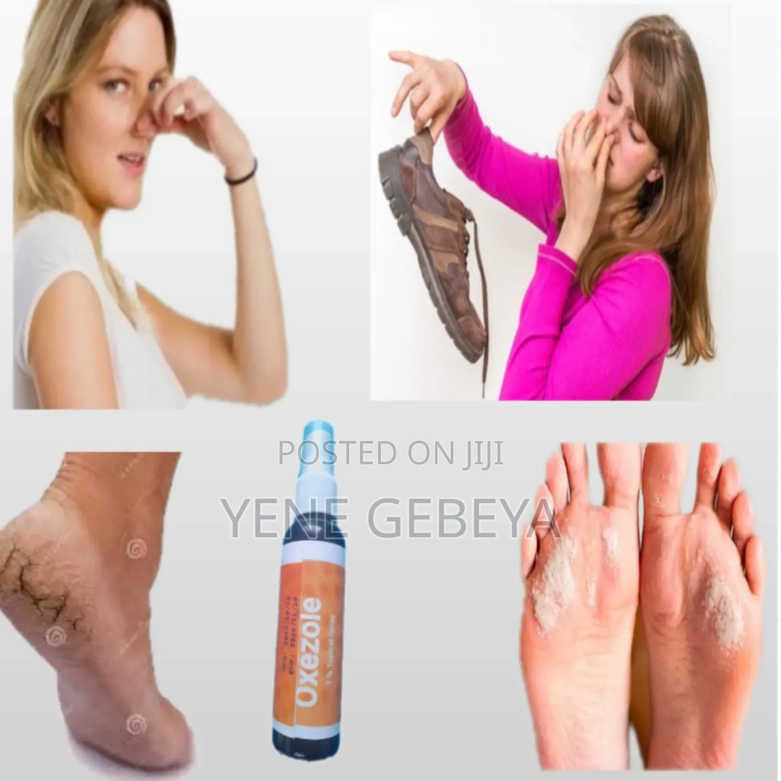 Oxizole Anti-Fungal
