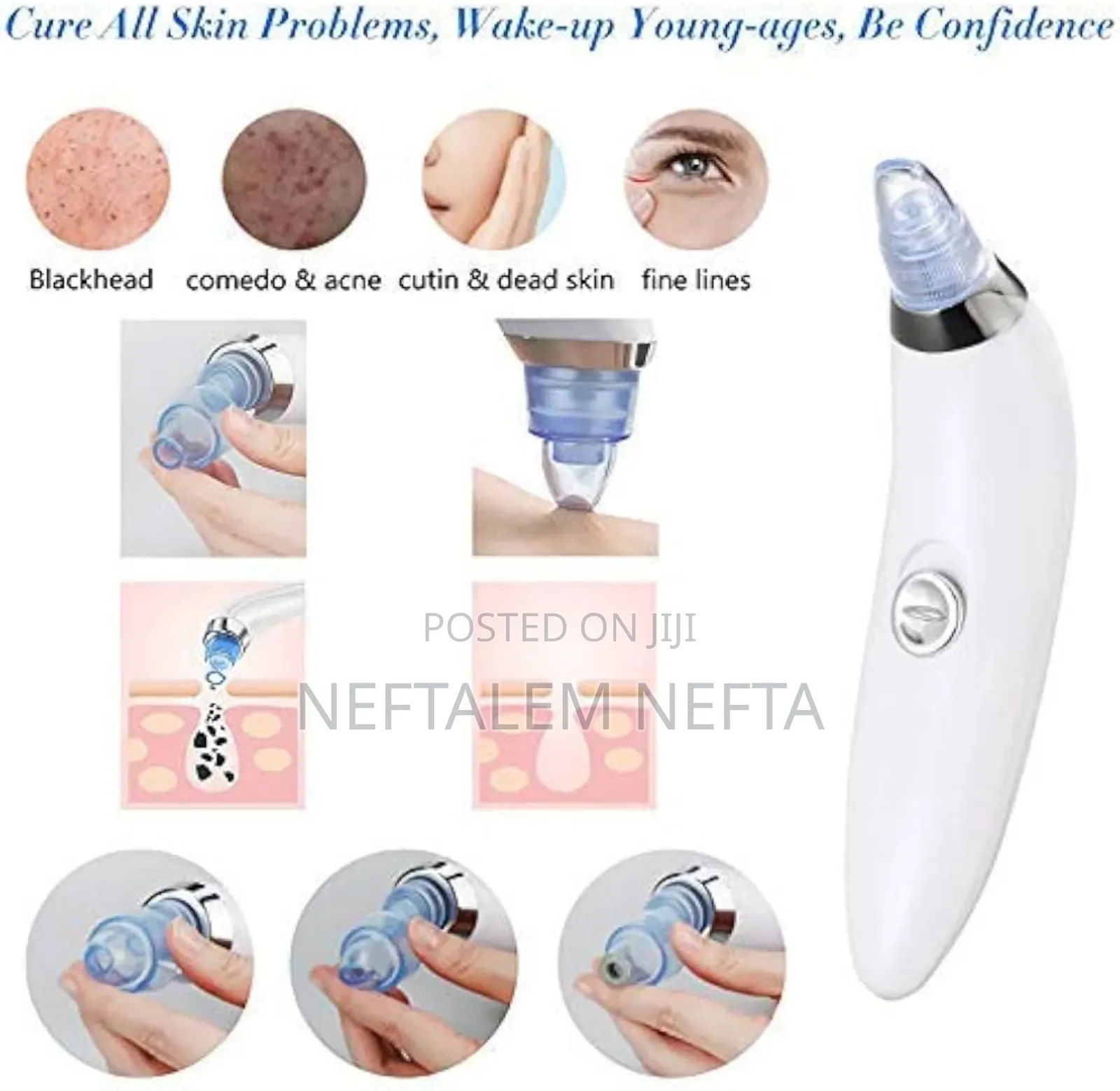 Facial Vacuum Blackhead Acne Pore Skin Cleaner