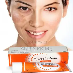Skinoren 20% Azelaic Acid Cream – Acne Dark Spot Treatment (30g)