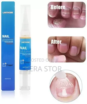 Lanthome Nail Repair