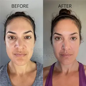 Metal Guasha Anti Aging Tool
