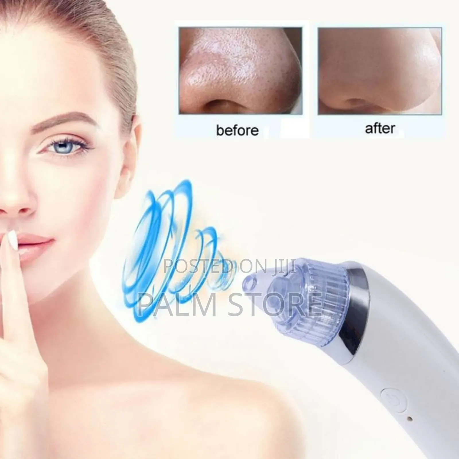 Dermasuction Facial Pore Cleaner