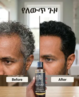 Melanix የሽበት ማጥፊያ