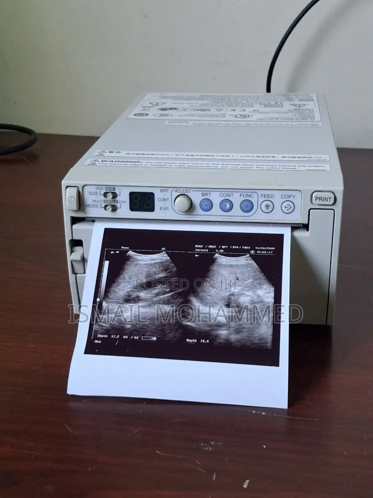 Slightly Used Mitsubishi Ultrasound Printer