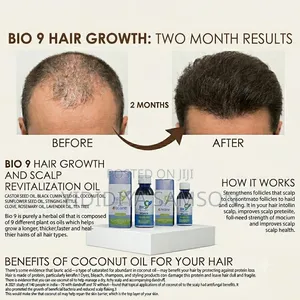 Bio 9 Hair Growth and Revitalization Oil