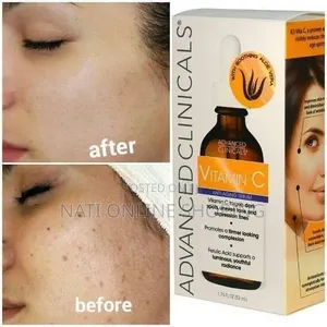 Advanced Clinicals Vitamin C Serum