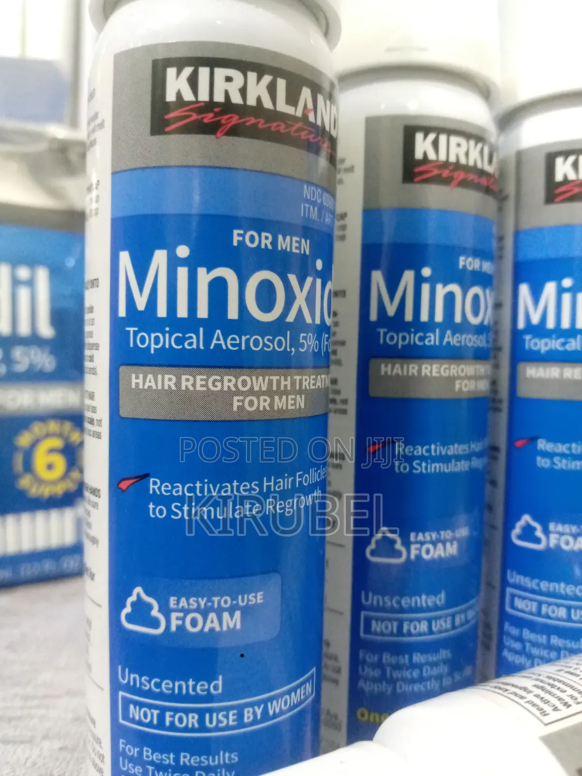 የፀጉርን ሙሉነት ለመመለስ ብቸኛውን መፍትሔ Foam Minoxidil