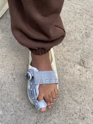 የተጣመመ አውራ ጣት ማስተካከያ