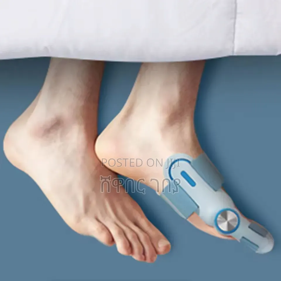 Orthopedic Bunion Splint - Adjustable Big Toe Corrector የአውራ ጣት ማስተካከያ
