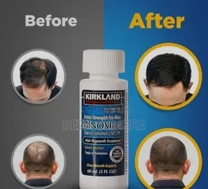 Premium Hair Regeneration Liquid 5% Minoxidil Intensive Root Activator