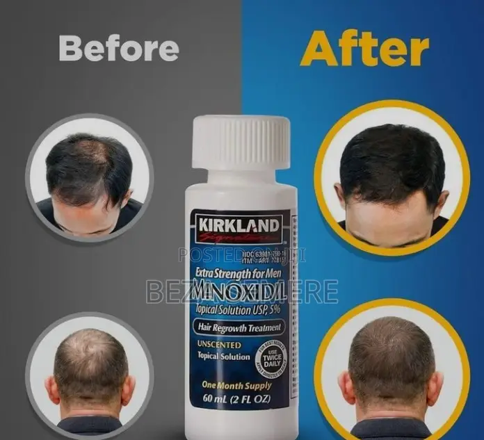 Premium Hair Regeneration Liquid 5% Minoxidil Intensive Root Activator