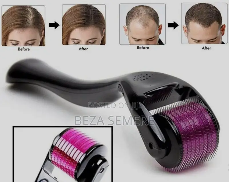 Titanium Derma Roller - ለፊት እና ለፂም ማሳደጊያ የሚሆን