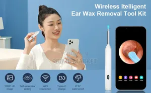 Ear Wax Cleaner Kit With Hd Camera Led Lights | Ios Android Phones