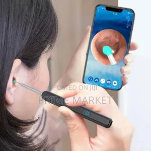 Smart Ear Wax Removal Endoscope