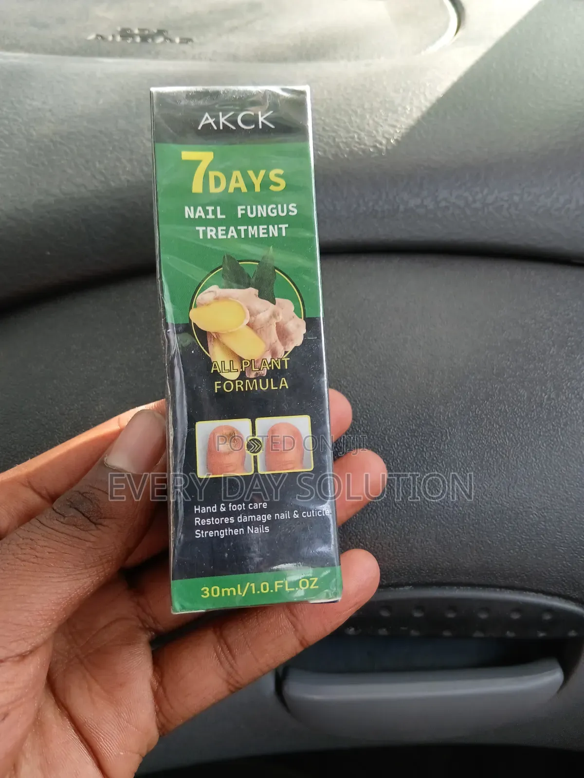 Akck 7 Days Nail Fungus Treatment 30ml – ለጥፍር ፈንገስ እንክብካቤ