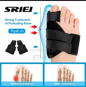 Toe Separator