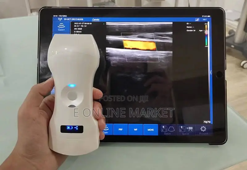 Wirless Ultrasound (3in1)