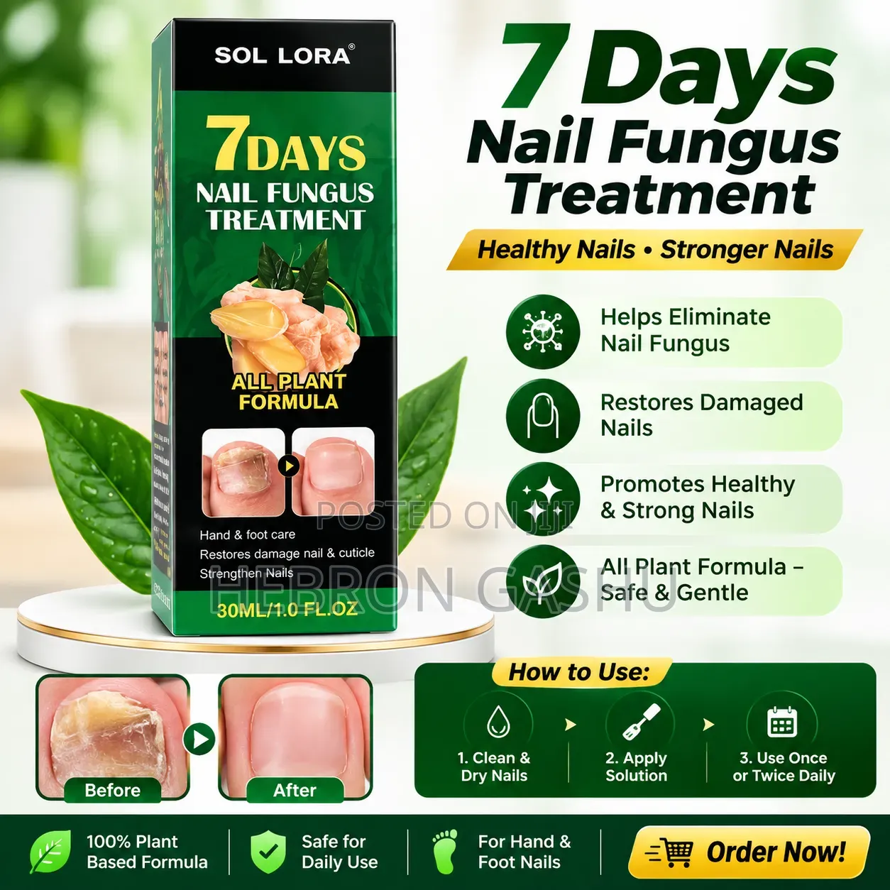 SOL LORA 7 Days Nail Fungus Treatment 30ml | ለጥፍር ፈንገስ እና ጥፍር ጥገና