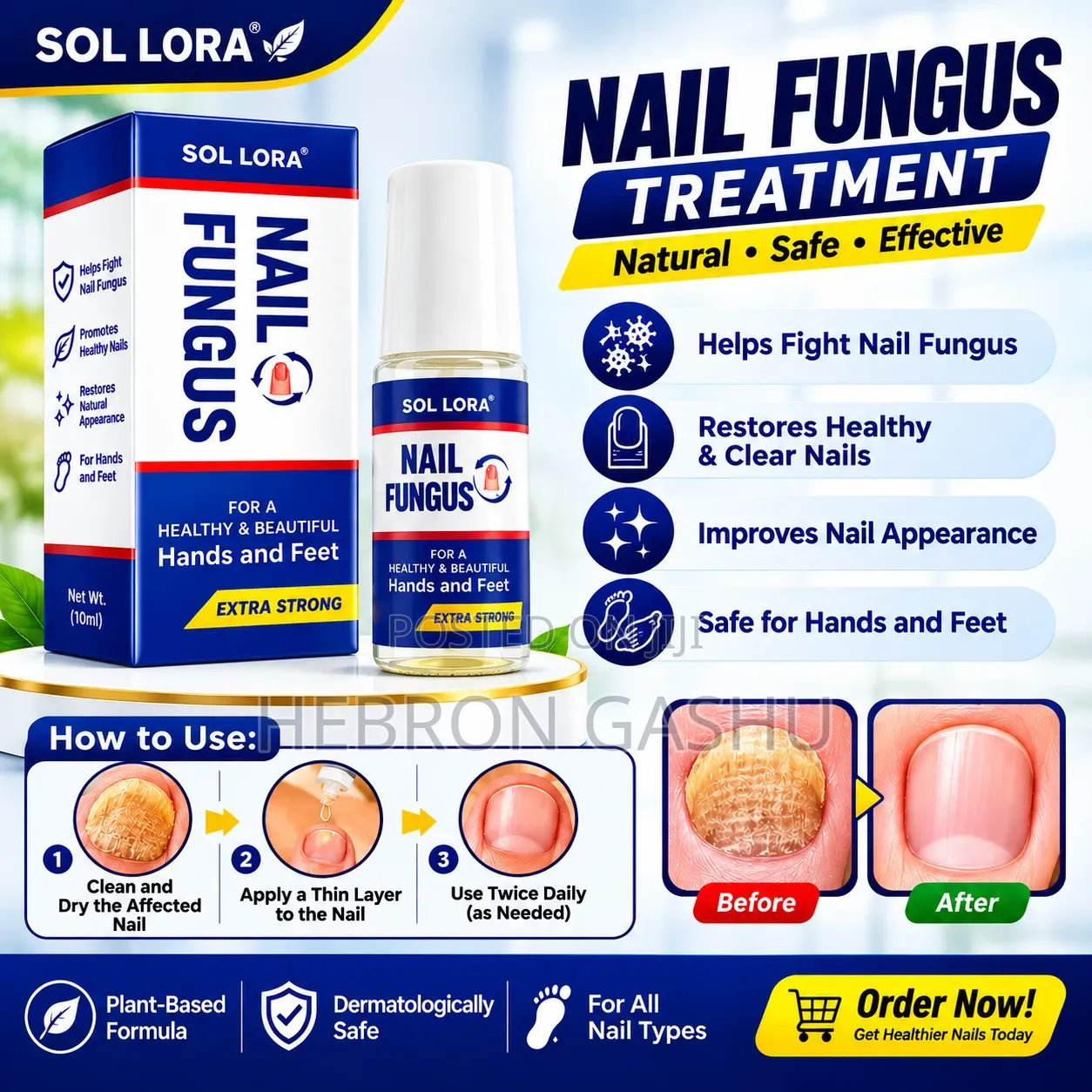 SOL LORA Nail Fungus Treatment | ለእጅና ለእግር ጥፍር ፈንገስ መከላከያ