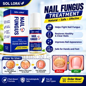 SOL LORA Nail Fungus Treatment | ለእጅና ለእግር ጥፍር ፈንገስ መከላከያ