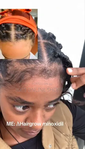 Hairgrow Minoxidil