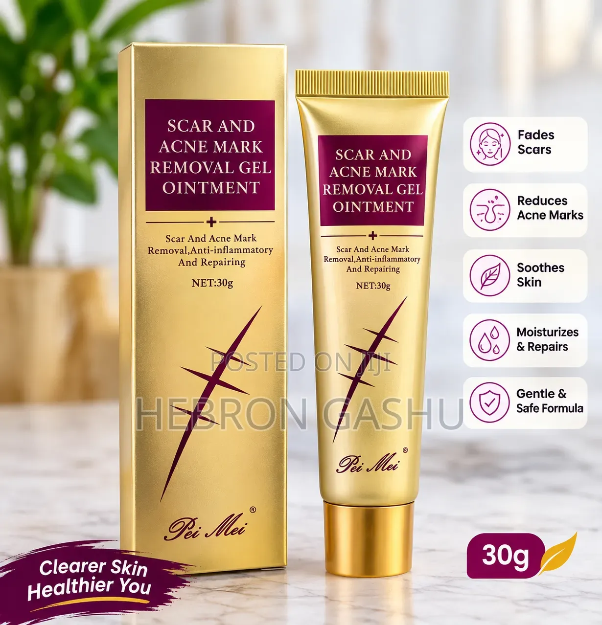 Acne Mark Removal Gel Ointment 30g – የጠባሳና የብጉር ምልክት ማስወገጃ ጄል