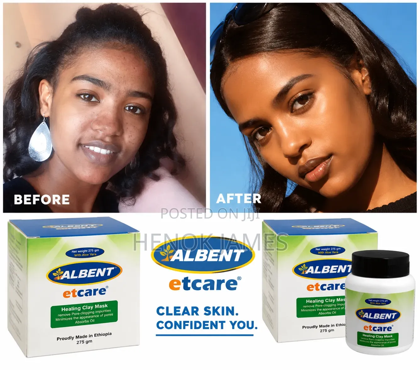 Albent Clay Mask