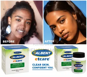 Albent Clay Mask