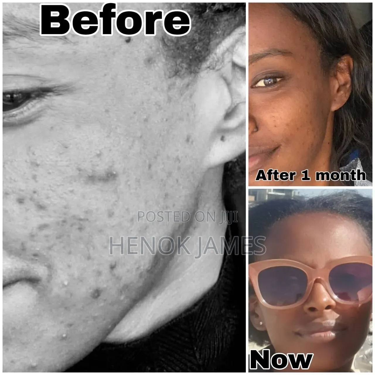 Albent Clay Mask