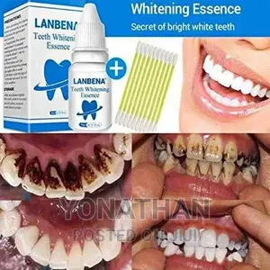 Lanbena Teeth Whitening