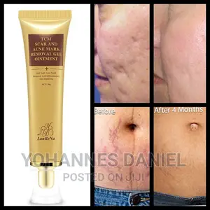 TCM Scar Removal