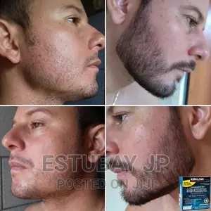 Minoxidil የወንዶች ፀጉር እና ፂም ማሳደግያ Original