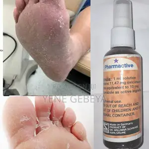 Oxzole Anti Fengal