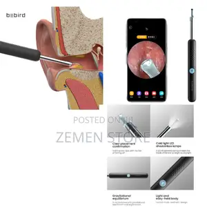 Smart Video Visual Ear Cleaner
