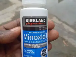 Minoxidil Hair Growth: Stimulate Follicle Regeneration