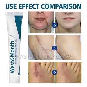 Silicone Scar Gel