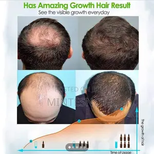 FEG Standard Hair Growth Spray 