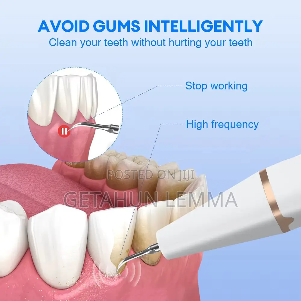 Ultrasonic Dental Calculus Remover