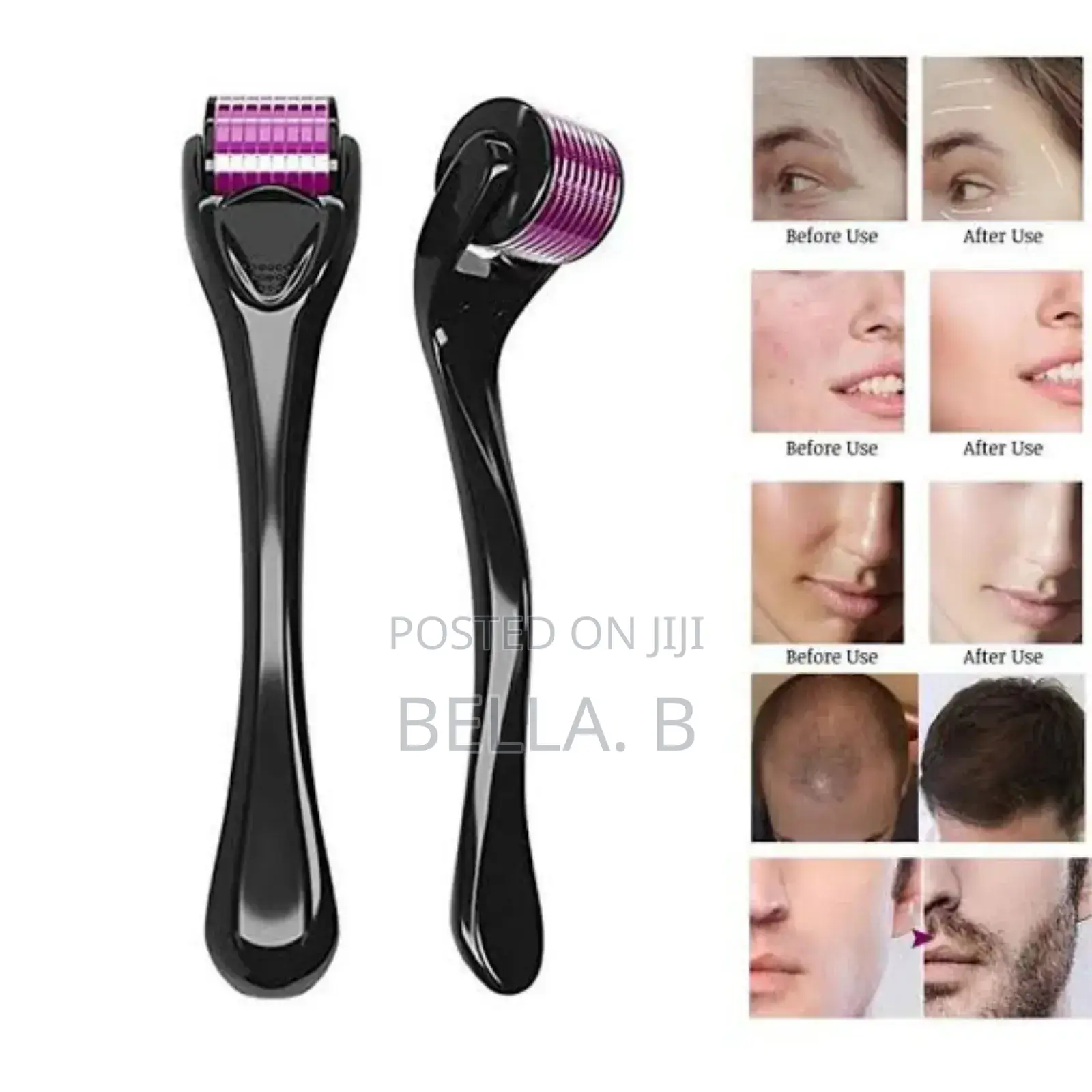 Derma Roller Special Revitilize And Renew