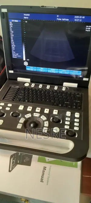 New Arrival
New Sonostar Ultrasound Machine Is Arrived