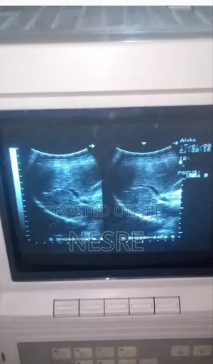  Used Ultrasound Machine
 Brand: Aloka
