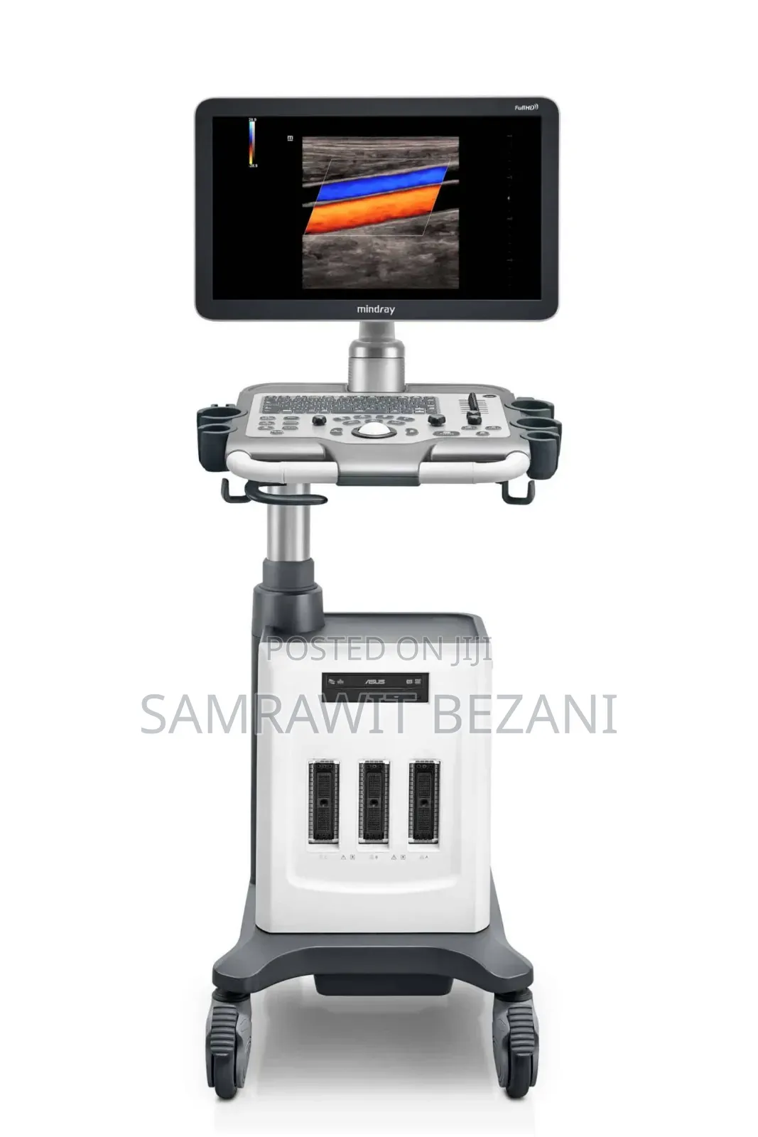 Ultrasound Machine