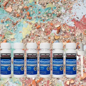 Minoxidil for Bald Men's Hair Loss