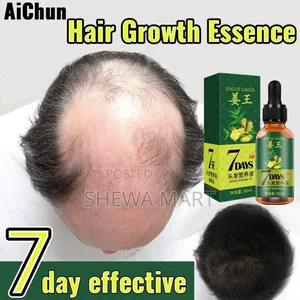 Hair Grow King of Ginger