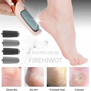 Calluses Remover